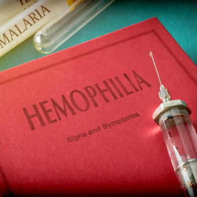 Precautions to take while traveling with hemophilia A